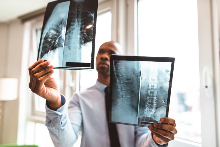 Spinal_Injury_Claims