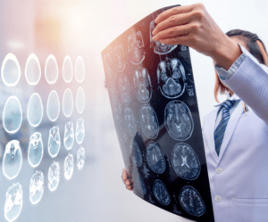 Traumatic Brain Injury Claim Know Your Rights and Seek Justice