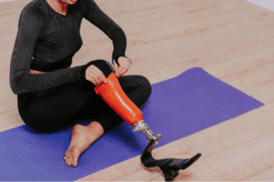 Claiming For A Personal Injury Following An Amputation