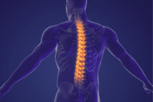 Spinal Cord Injury